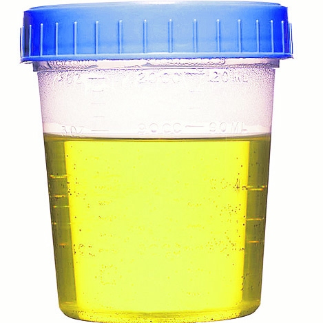 Autors:  No mountainside-medical.com