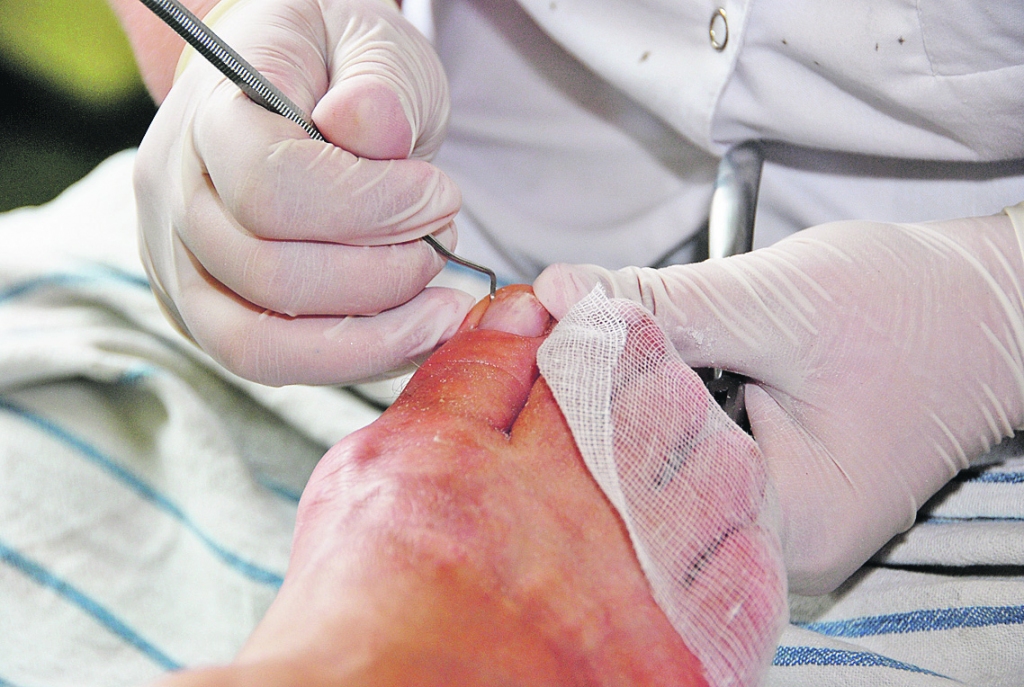 Vizīte pie podologa sākas ar diagnostiku – cik tad slikti īstenībā ar tām pēdām ir. Pēc diagnostikas kļūst skaidrāks, cik ilga ārstēšana nepieciešama, kāda būs turpmākā aprūpe un kad jāierodas uz nākamo procedūru.                                                                           
                                                                                                                                                                          
Autors:  DAINIS ĢELZIS