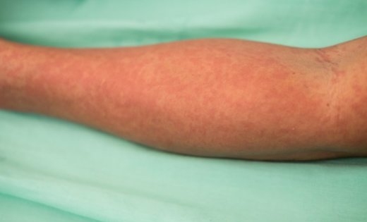 Autors: Shutterstock