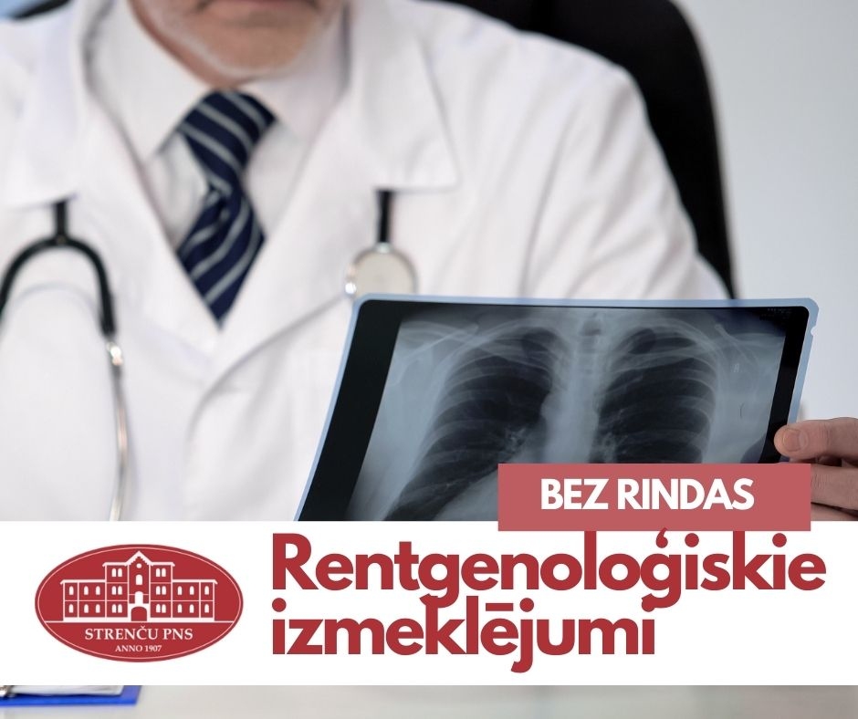 Autors: strencupns.lv